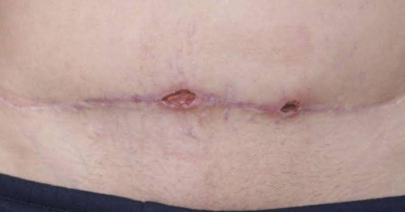 Dok. Verywell Health